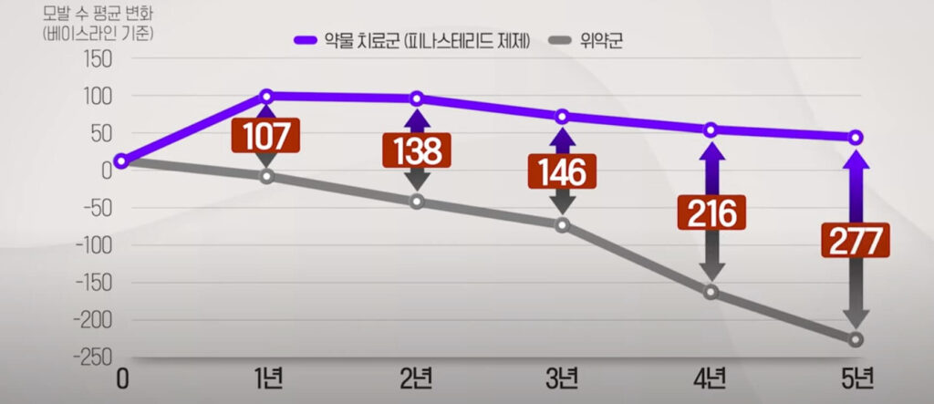 모발이식 후 약물치료 병행 결과 그래프 사진