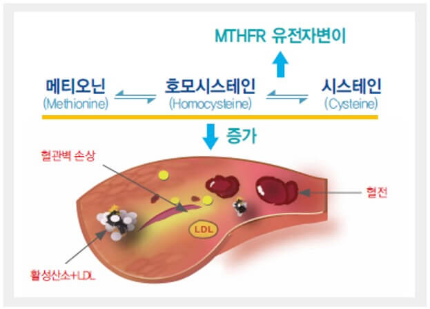 호모시스테인의 발생 원인 과정 설명